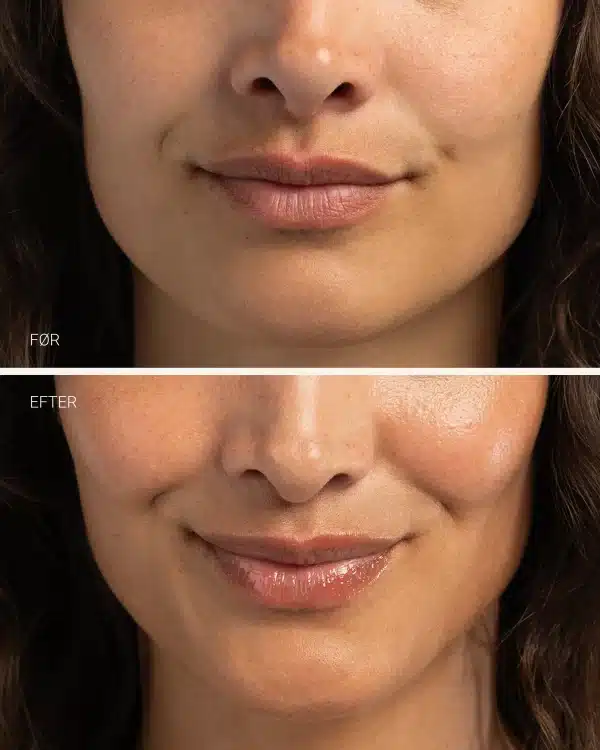 Hydrating lip balm - Sanzi beauty